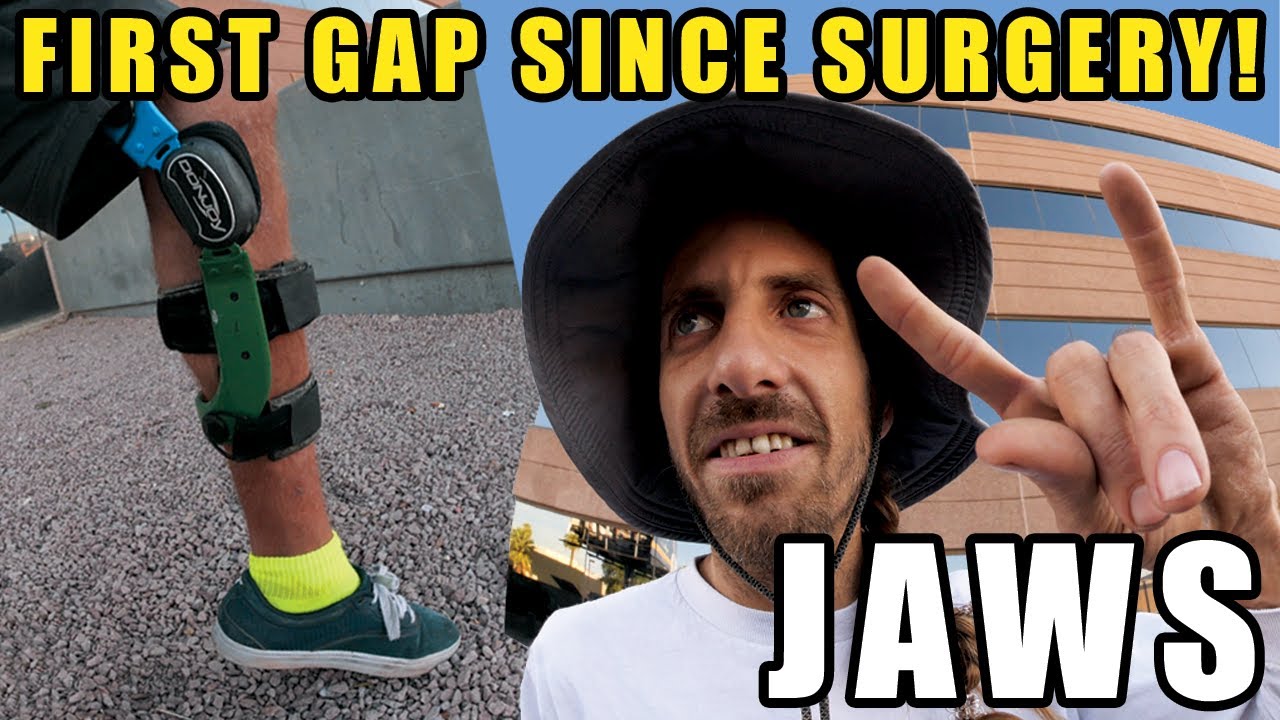 El primer gap de "Jaws" después de su operación
