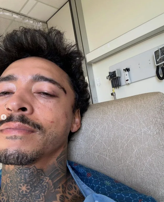 Nyjah Huston vuelve a caer duro: mandíbula, pómulo y riñón tocados