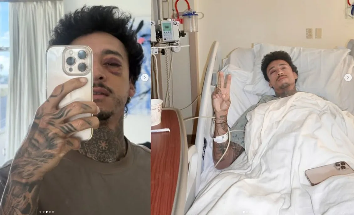 Nyjah Huston vuelve a caer duro: mandíbula, pómulo y riñón tocados